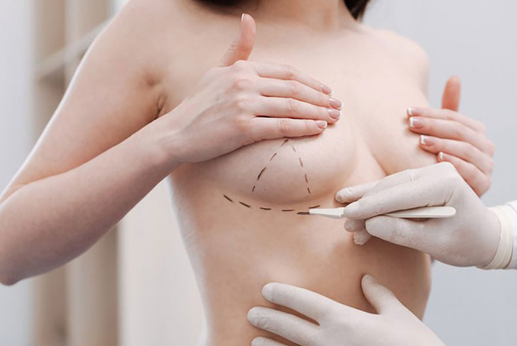 Muốn nâng vòng 1 tròn căng, đây là 10 cách không đụng dao kéo - 1