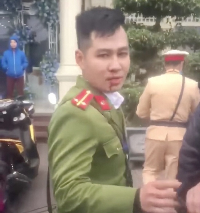 Tài xế vi phạm giao thông đấm chảy máu mũi trung uý công an ở Hải Phòng - 2