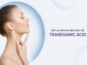 Cải thiện nám mãi không hết, có nên nhượng bộ?