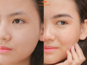 Sở hữu lông mày đẹp tự nhiên nhờ công nghệ tạo sợi Fly Brows tại Chance Kim