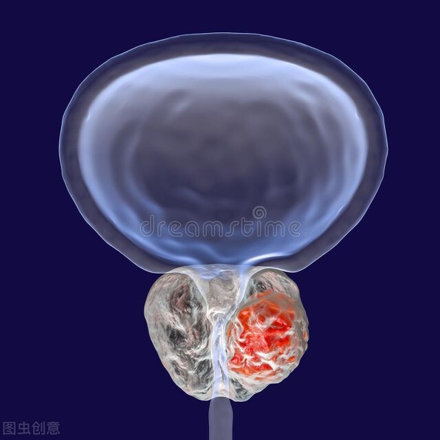 Tuyến tiền liệt "sợ" nhất những điều này với các cặp đôi - 1