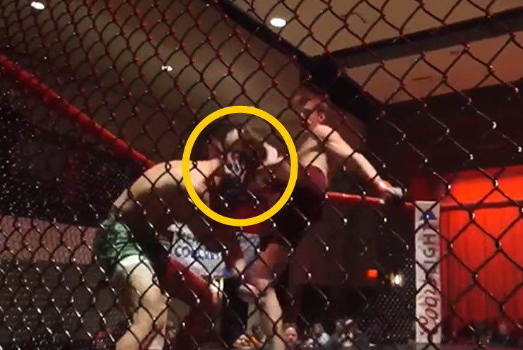 Chấn động MMA: Võ sĩ knock-out được đối thủ nhưng chân gãy làm đôi - 1
