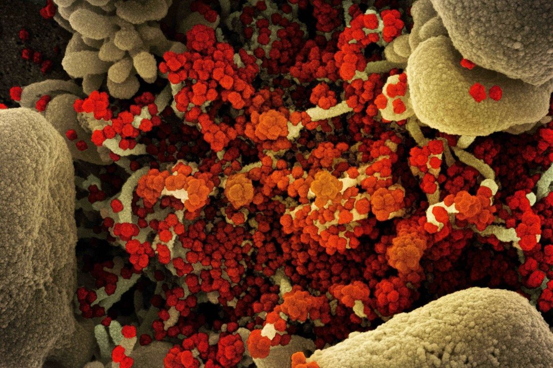 Chuyên gia: Biến thế Omicron có thể hình thành từ cơ thể bệnh nhân HIV - 1