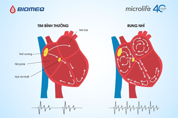 Bảo quản máy đo huyết áp 24h như thế nào để bảo đảm chính xác của kết quả đo?
