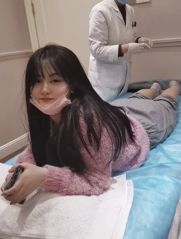  Rùng mình vì các chị em cắt bỏ dây thần kinh ở chân để có “đôi chân trong truyện tranh“