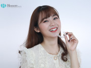 6 Months Smile - cải thiện răng cửa siêu tốc cùng Nha khoa Blossom