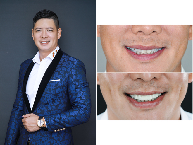 Song Luân, Bình Minh cùng khoe nụ cười mới - Khi đàn ông cũng có quyền làm đẹp - 2