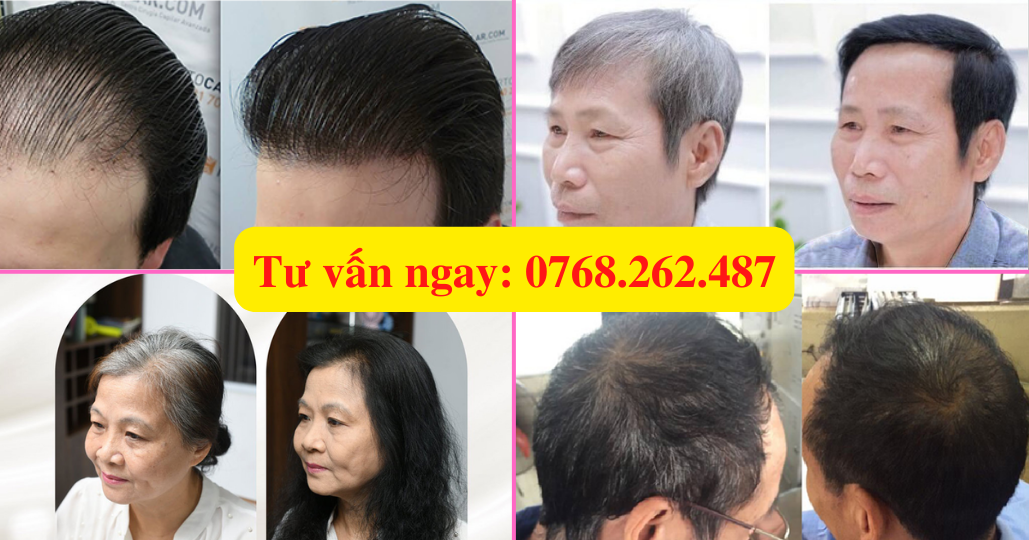 Bí quyết giúp tóc đen óng ả của cô giáo U50 - 4