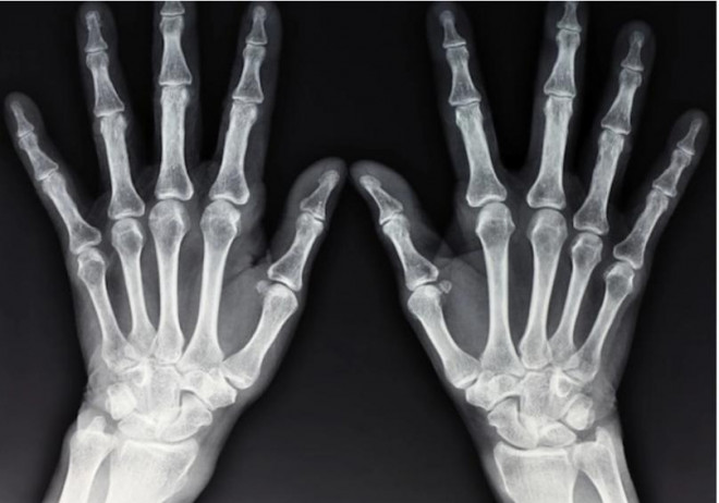 Tấm ảnh X-quang đầu tiên của nhân loại và ngành kỹ thuật hình ảnh y học - 3