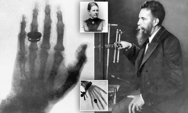 Tấm ảnh X-quang đầu tiên của nhân loại và ngành kỹ thuật hình ảnh y học - 2