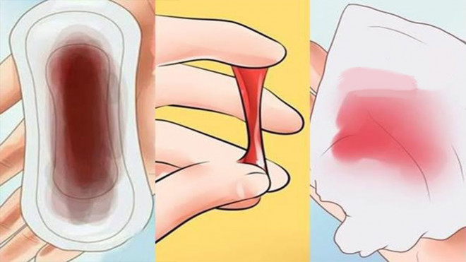 Cô gái 29 tuổi mắc ung thư chỉ vì 1 sai lầm phổ biến khi giặt đồ lót,hãy bỏ ngay thói quen này - 2