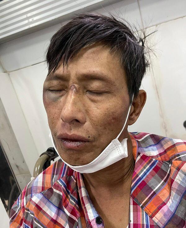 Đối tượng nhiễm HIV đâm người bị thương, vung rìu chống trả cảnh sát khi bị truy bắt - 1