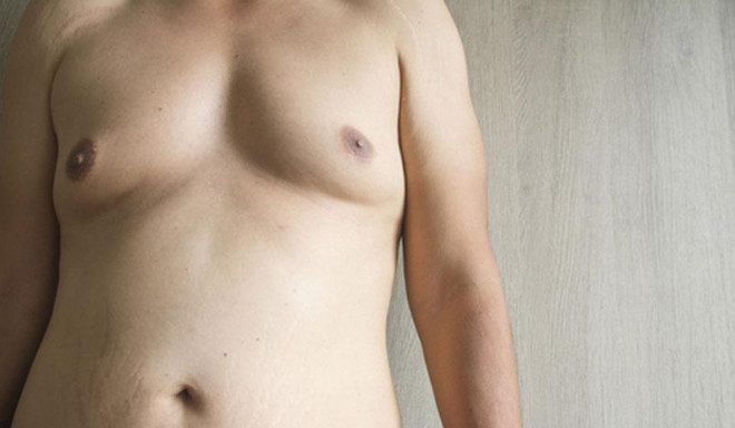 Các dấu hiệu nhận biết sớm hội chứng khiến nam giới không có tinh trùng - 1