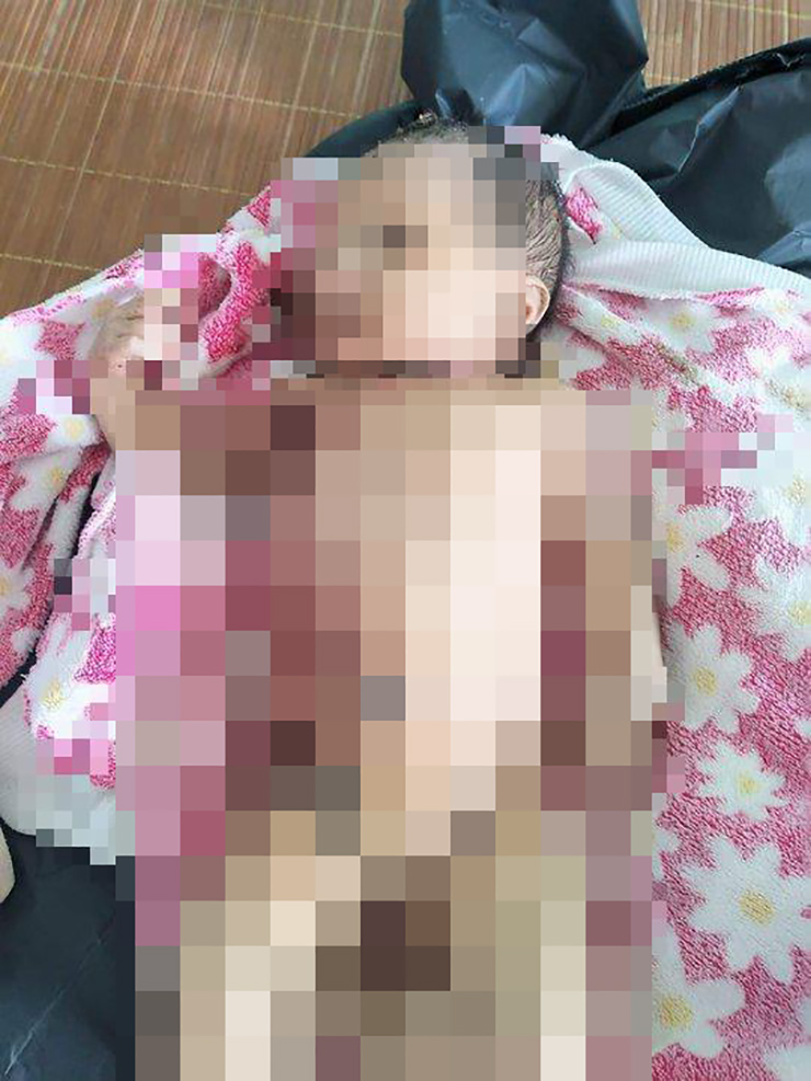 Quảng Nam: Xót xa bé sơ sinh bị bỏ rơi giữa rừng, giòi bám đầy người - 1