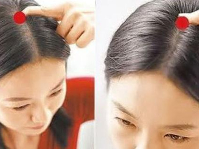 Cơ thể con người có 5 ”công tắc” để mọc tóc, hãy bấm mỗi ngày để ngăn rụng tóc và tạm biệt hói đầu