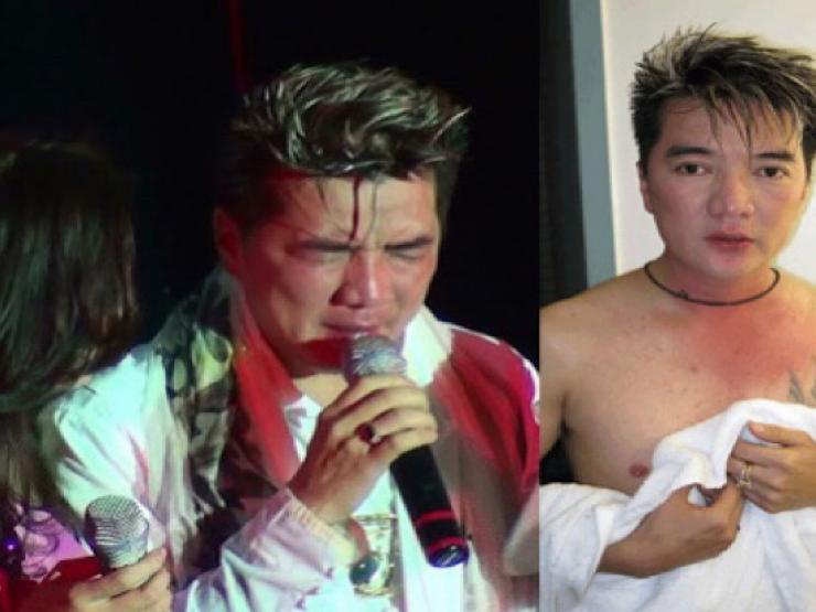 Ca sĩ bị hành hung, đánh hội đồng khi đi hát và muôn vàn tai nạn oái oăm “khó đỡ”
