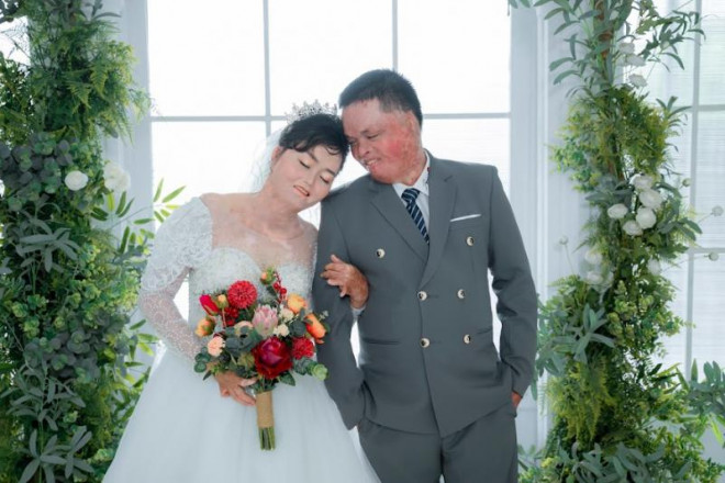 Hạnh phúc ngọt ngào của người phụ nữ từng bị thiêu sống - 1