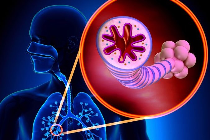 Cẩn trọng với căn bệnh khiến nhiều người mắc bệnh và có nguy cơ tử vong cao trên thế giới - 2