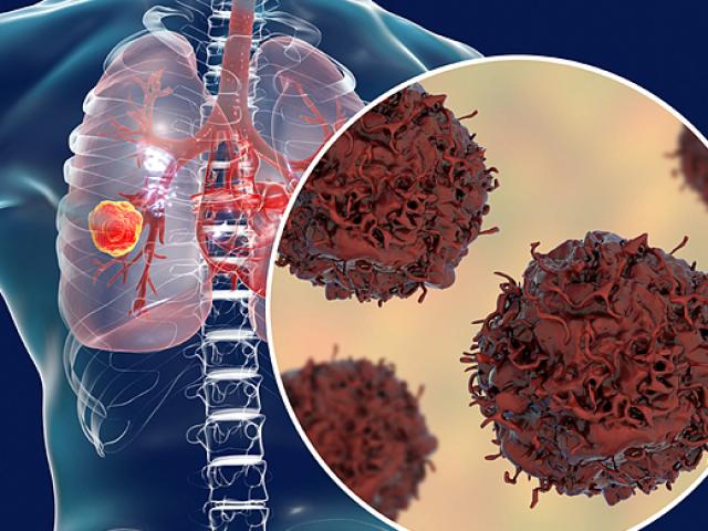 2 lá phổi quý giá dễ tổn thương nghiêm trọng, thậm chí bị ung thư nếu bạn không biết điều này