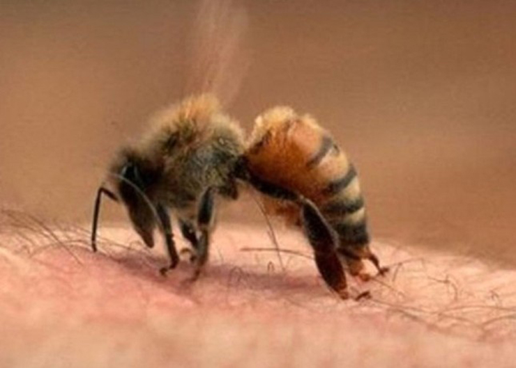 Ong vò vẽ là loại ong vùng rừng núi rất độc và nguy hiểm, nọc của chúng có thể gây tổn thương da và để lại vết thương, nọc độc ong vò vẽ còn có thể gây tử vong nếu như không được sơ cứu và cấp cứu kịp thời

