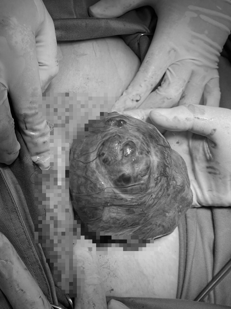 5 lưu ý không thể bỏ qua dành cho chị em đã từng sinh mổ - 2