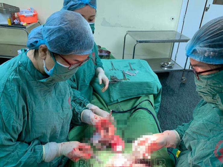 50 triệu ca mới gặp 1: Người phụ nữ mang thai đôi từ 2 tử cung khác nhau