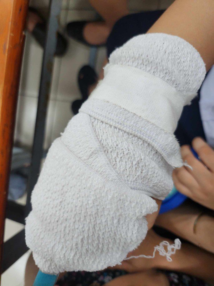 TP HCM: Phụ huynh tố giáo viên đánh gãy xương ngón tay học sinh - 1