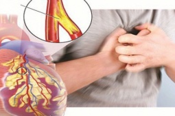 Nguy cơ suy tim do bệnh động mạch vành và cách phòng ngừa