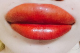 Thuốc thảo dược giúp giảm sưng nề, mau lành vết thương khi phẫu thuật thẩm mĩ