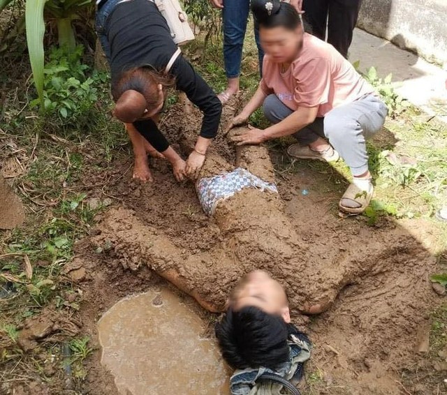 Em lao vào cứu anh trai bị điện giật, cả 2 bị thương nặng - 1